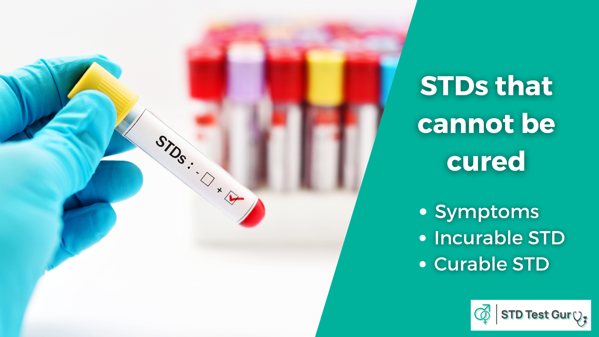 STDs that cannot be cured