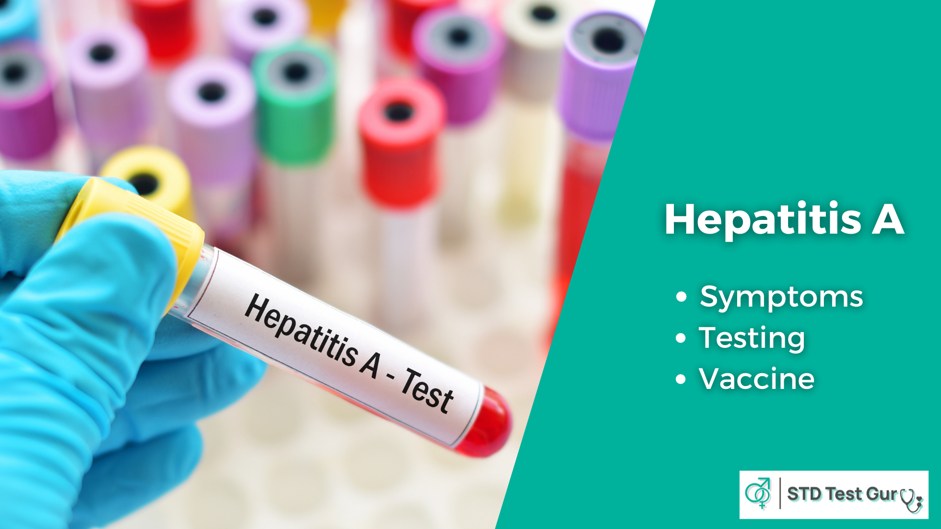 Hepatitis A - STDTestGuru